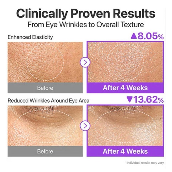 NAD+ BIO Lifting-sil Essence Serum - Purple - Picture 6 of 7